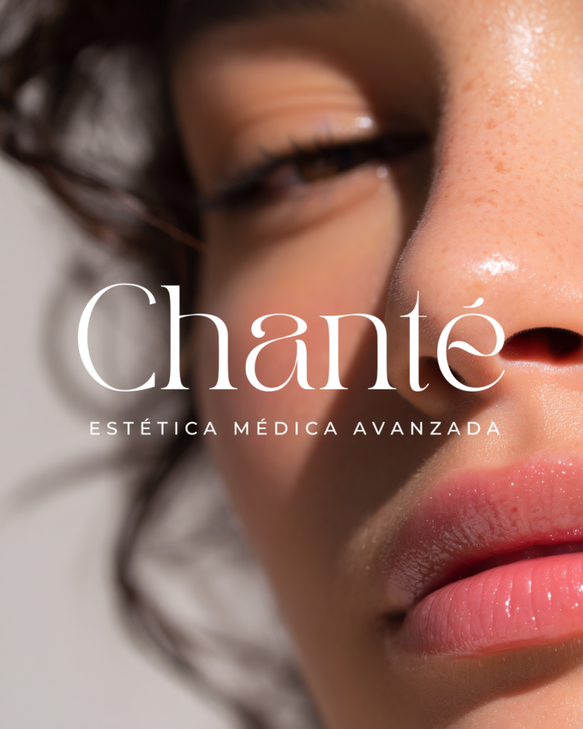 imágenes para rrss chanté